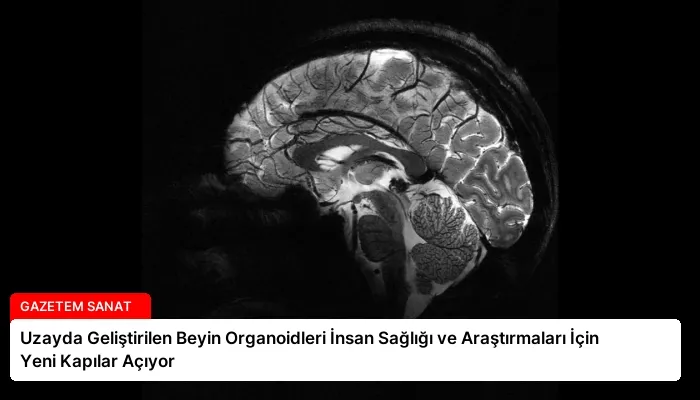 Uzayda Geliştirilen Beyin Organoidleri İnsan Sağlığı ve Araştırmaları İçin Yeni Kapılar Açıyor