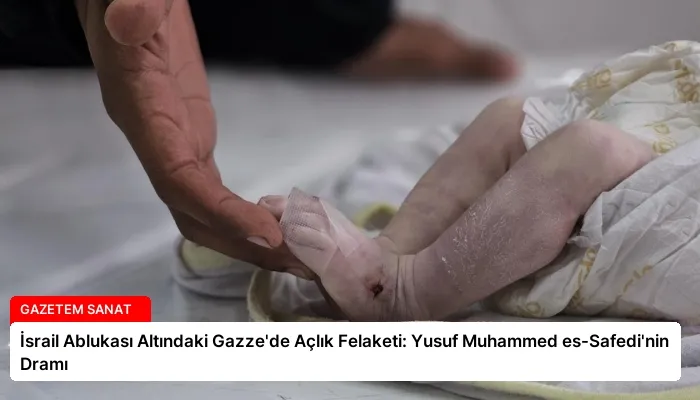İsrail Ablukası Altındaki Gazze’de Açlık Felaketi: Yusuf Muhammed es-Safedi’nin Dramı