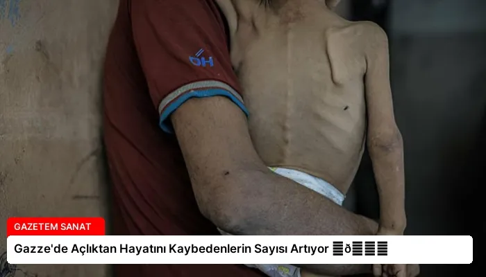 Gazze’de Açlıktan Hayatını Kaybedenlerin Sayısı Artıyor ⏬👇