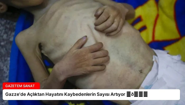 Gazze’de Açlıktan Hayatını Kaybedenlerin Sayısı Artıyor ⏬👇