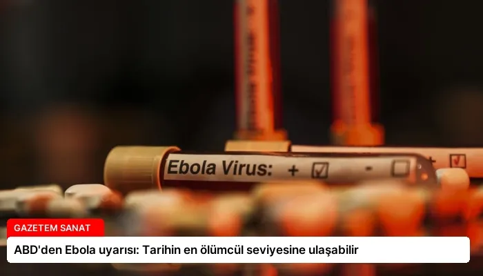 ABD’den Ebola uyarısı: Tarihin en ölümcül seviyesine ulaşabilir