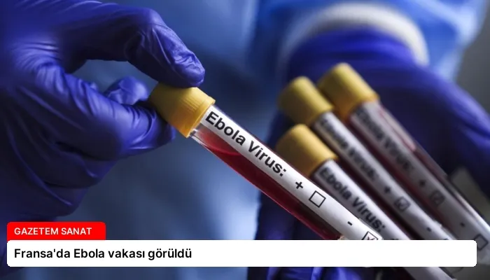 Fransa’da Ebola vakası görüldü